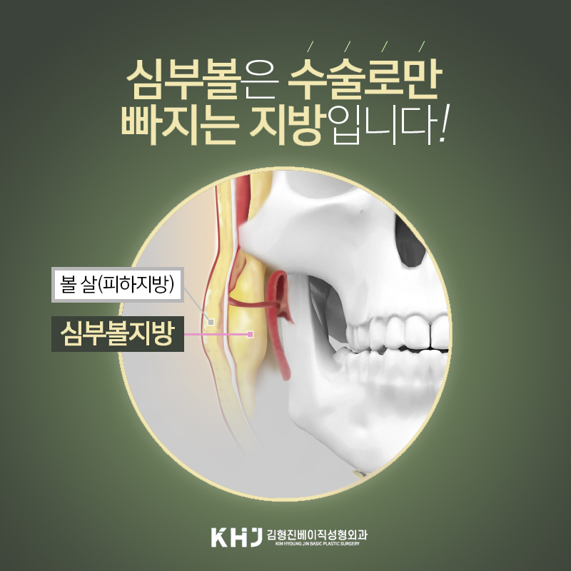 턱선이 예뻐지는 압구정심부볼지방제거 찾고 있다면? 관련 이미지 4