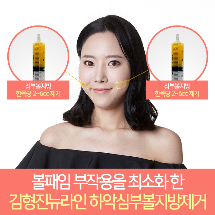 하악심부볼지방제거 어디다? 김형진뉴라인성형외과다! 관련 이미지 4