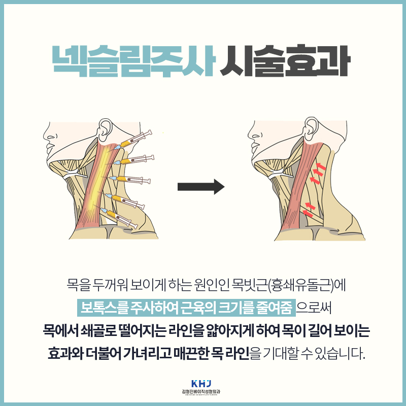 넥슬림주사후기 어떤 사람이 맞으면 좋을까? 관련 이미지 4