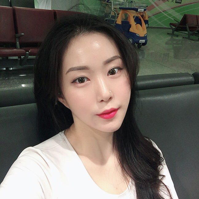 얼굴지방흡입 받고 이미지 변신 제대로 했어요 관련 이미지 1