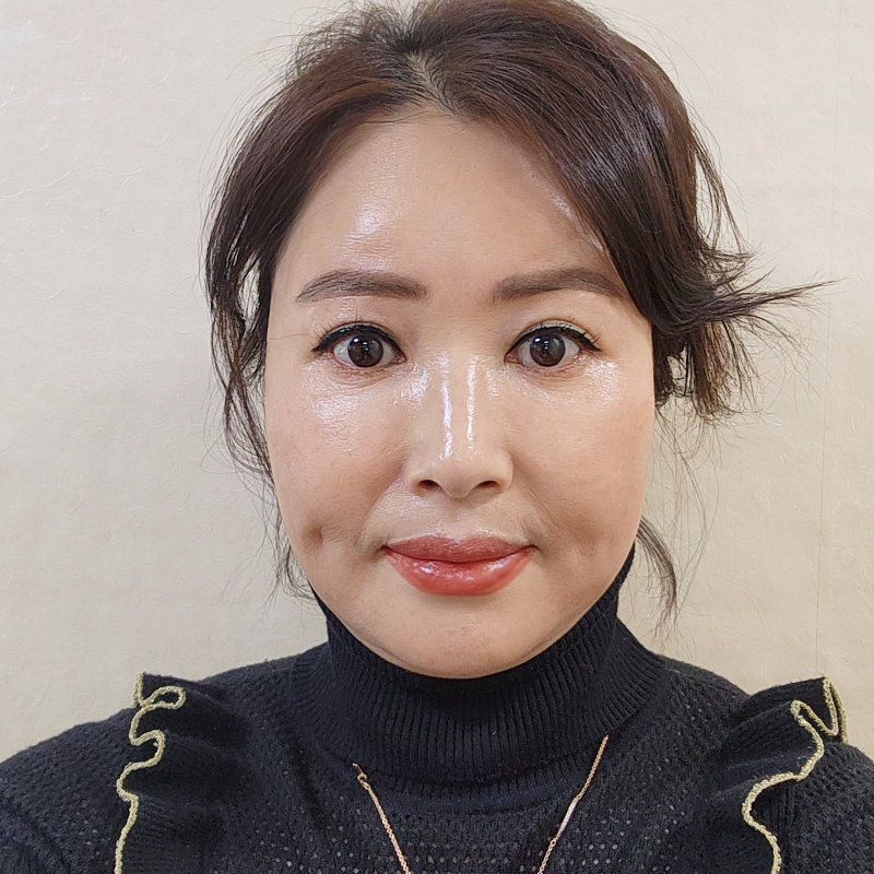 미니하안검절개 걱정은 이제 그만! 관련 이미지 1