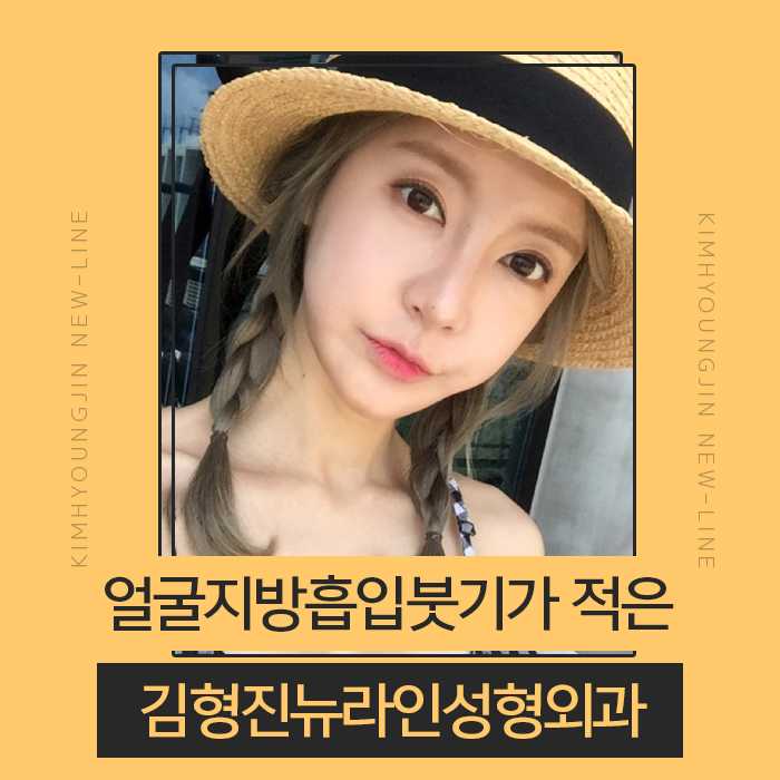 얼굴지방흡입붓기 솔직히 없을 순 없어요 관련 이미지 1