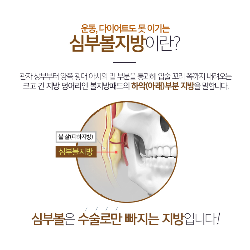 심부볼리프팅의 핵심, 이것 밖엔 방법이 없습니다! 관련 이미지 5