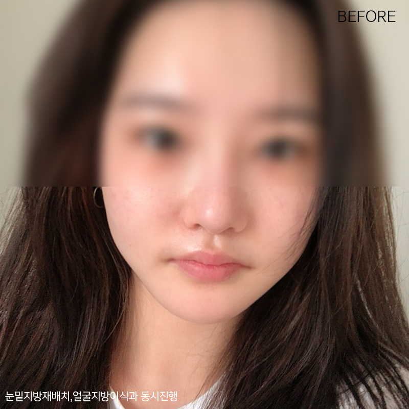얼굴지흡방법 아직 모르신다구요? 관련 이미지 2
