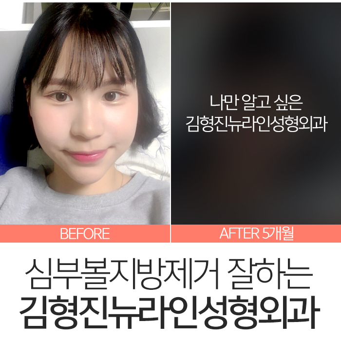 심부볼만 했어요 관련 이미지 3