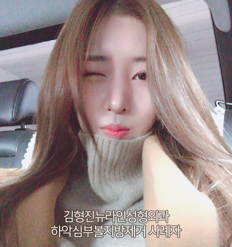 심부볼패임 무조건 온다고? 관련 이미지 1