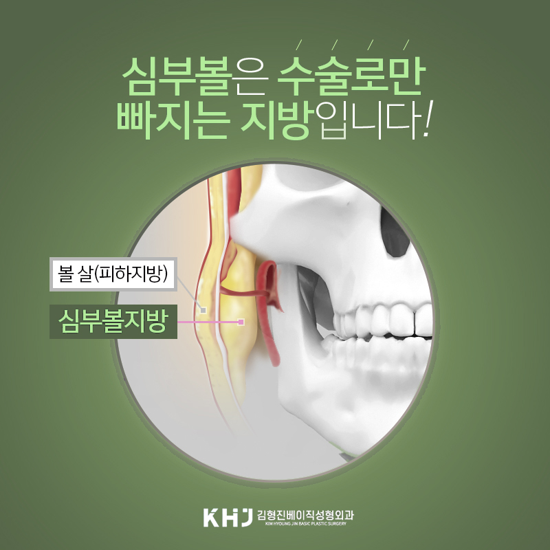 압구정얼굴지방흡입 맛집 찾는 분? 멀리갈 필요 없어요 관련 이미지 5