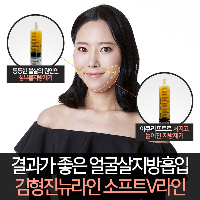 얼굴살지방흡입 하려면 이걸 해야지! 관련 이미지 3