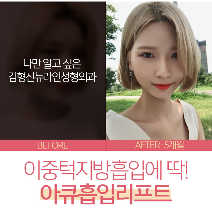 턱살지흡 진짜일까? 관련 이미지 6