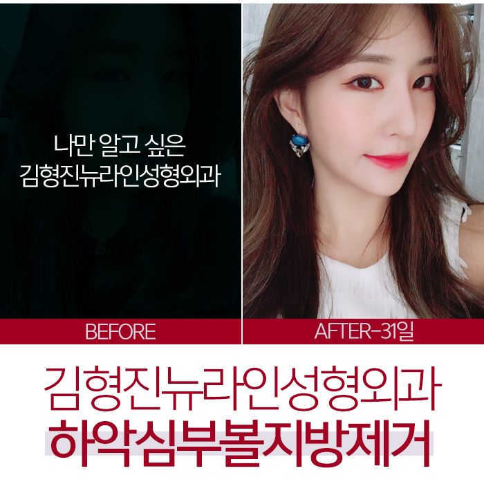 볼살없애는법 그동안 잘못 알고있던 사실 관련 이미지 7