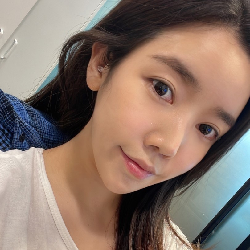 빠르게 눈밑지방없애는방법으로 선택한 눈밑지방재배치, 후회 없어요 관련 이미지 1