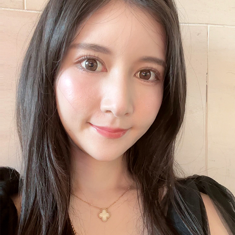 눈밑재수술 걱정마세요! 김형진베이직이 있잖아요! 관련 이미지 3