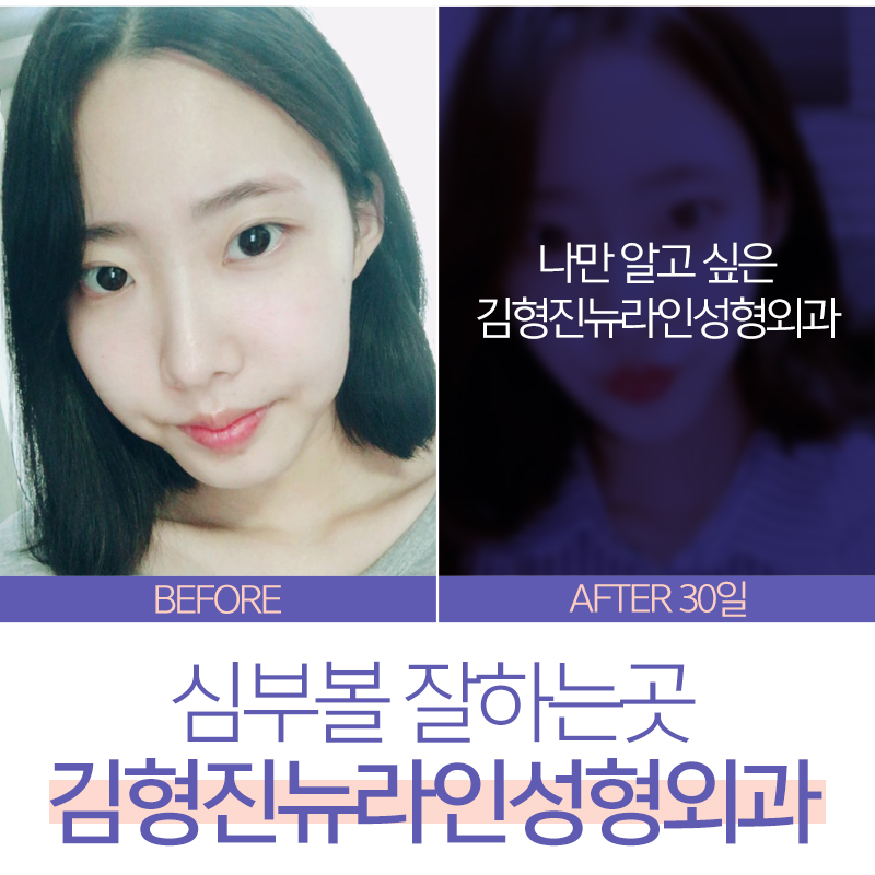 심부볼잘하는곳 이거레알 반박불가 관련 이미지 2