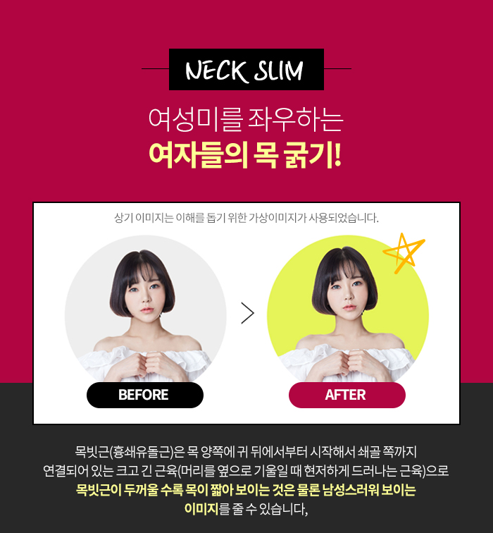 넥라인보톡스 진짜 해야 할때 (a.k.a 김형진베이직 넥슬림주사) 관련 이미지 4