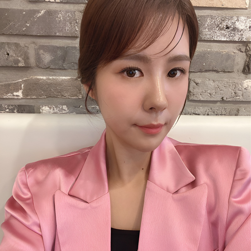 Why I Never Had to Go Back After Lower Eyelid Fat Removal image 2