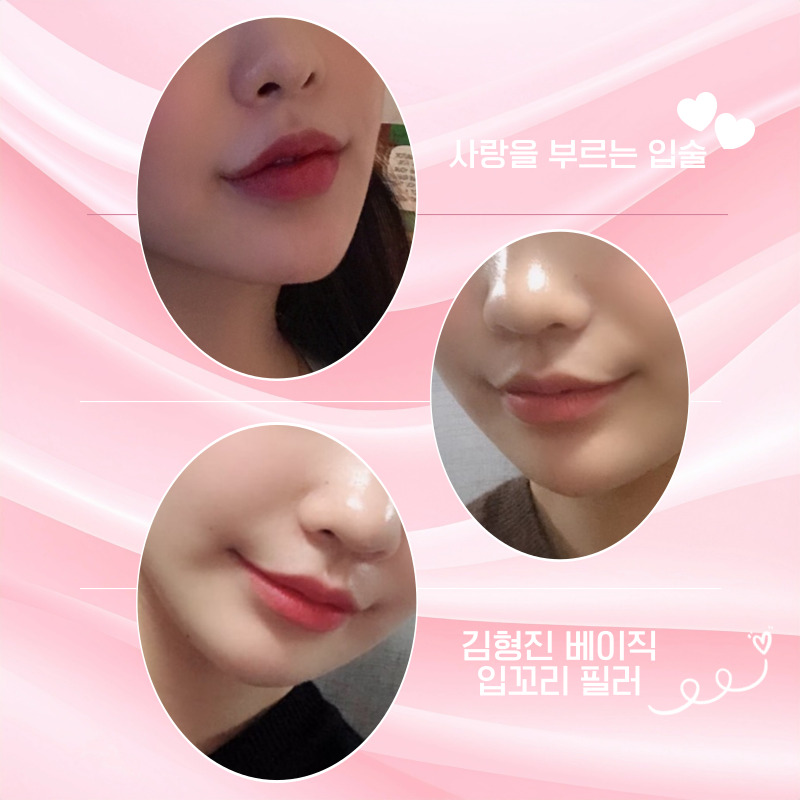 너무 쉽게 입꼬리올리는법 김형진베이직에서 알려드려요! 관련 이미지 4