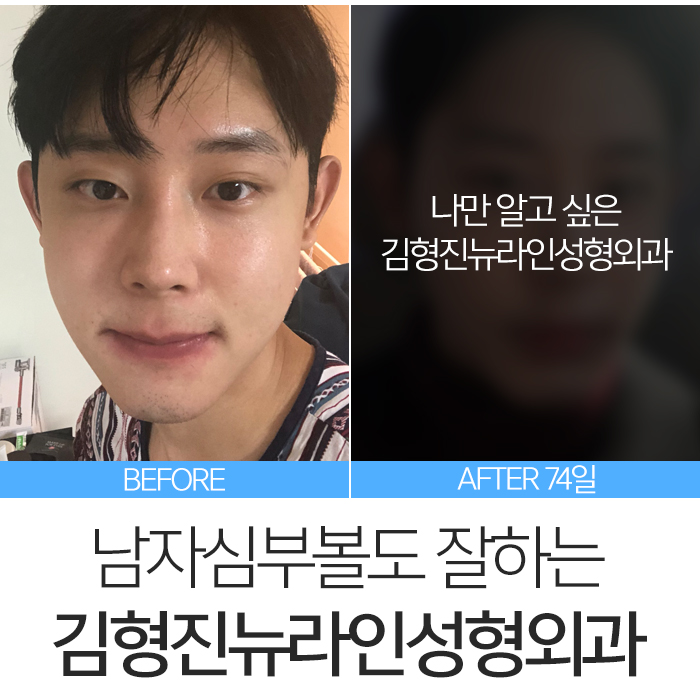 남자심부볼 깔끔하게 정리해요 관련 이미지 3