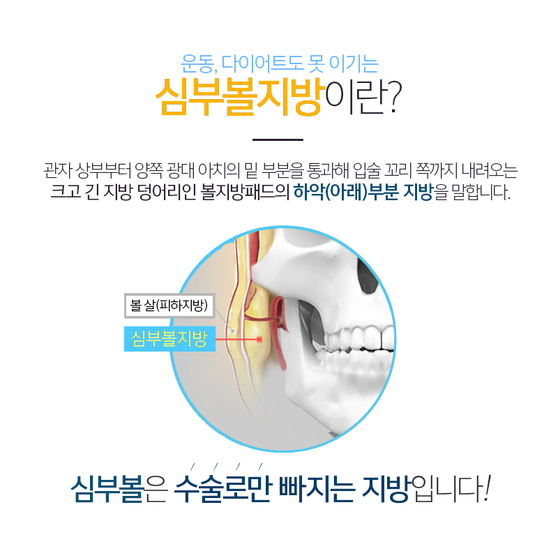 아직도 심부볼지방없애는법 고민하고 계신다면? 관련 이미지 3