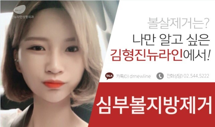 볼살제거하는방법 지방흡입이 답이 아니에요! 관련 이미지 3