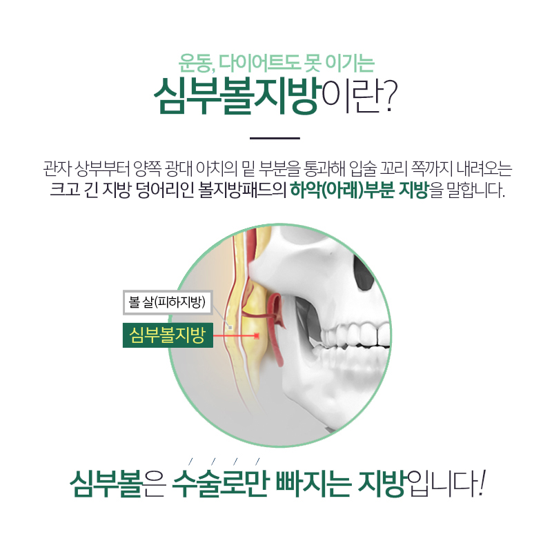 심부볼볼패임 때문에 망설이고 계신 분 들어오세요! 관련 이미지 4