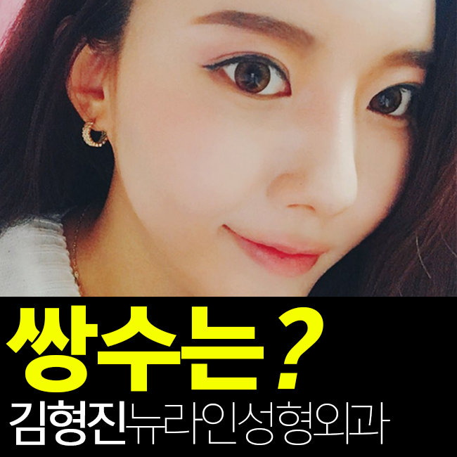 학생 쌍수 후기 리얼로 보니 하고 싶잖아~ 관련 이미지 1