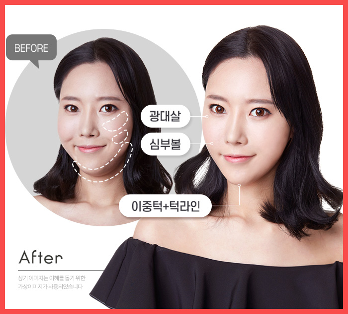얼굴작아지는법 이것저것 하지말고 하나만 딱! 관련 이미지 4