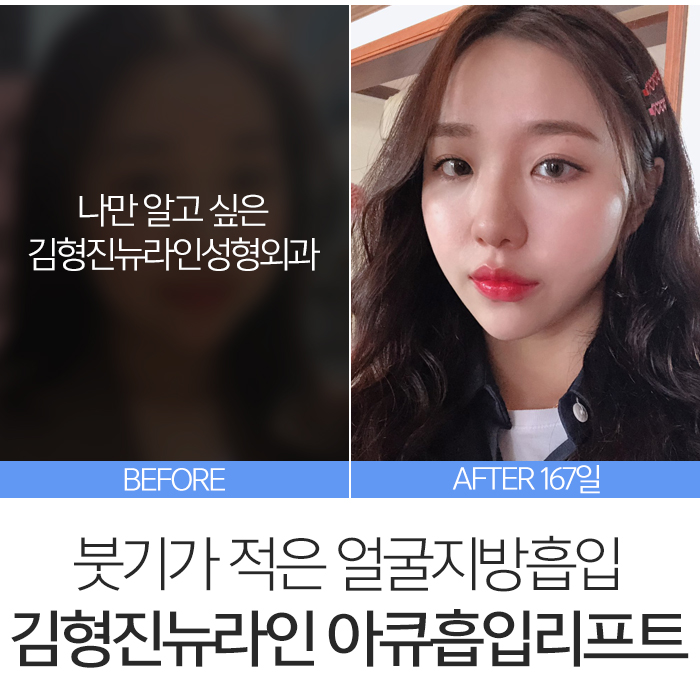 아큐스컬프 붓기 때문에 고민? 관련 이미지 8