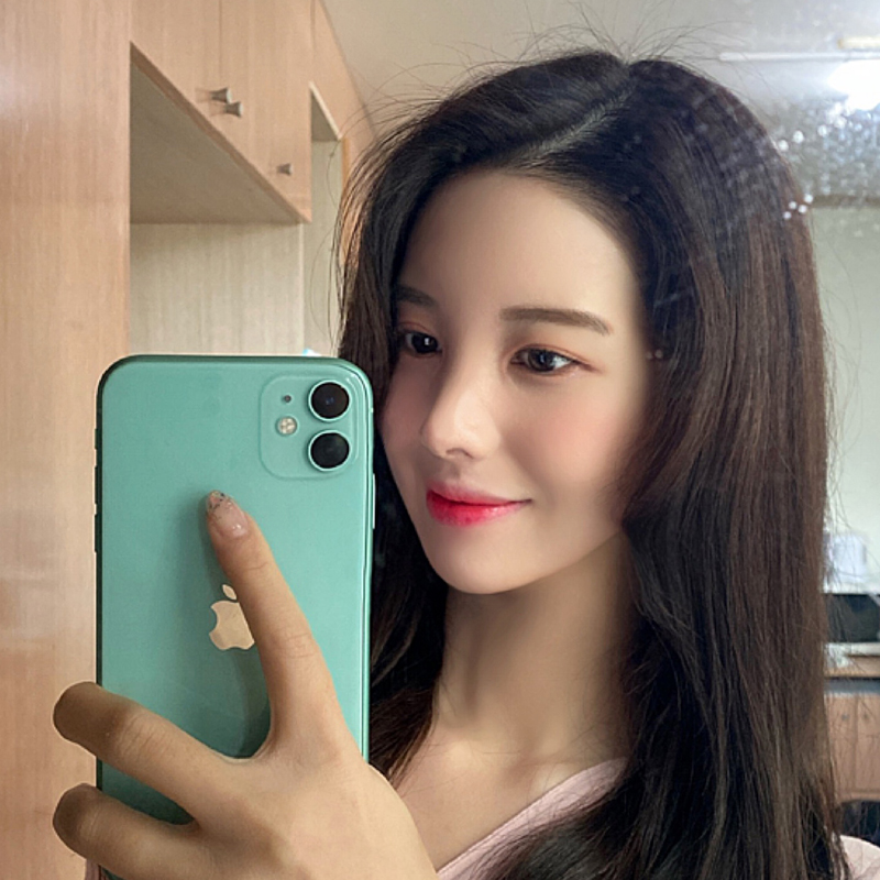 이중턱지방흡입전후 차이가 큰 김형진베이직 관련 이미지 5