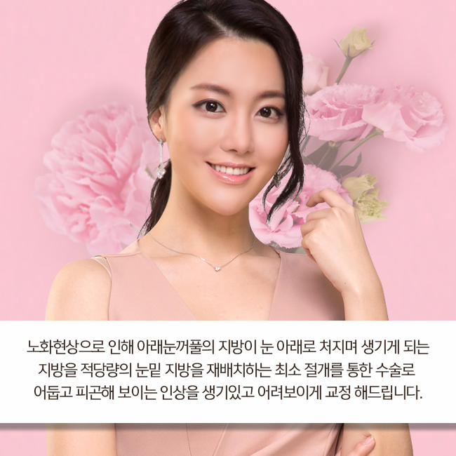 눈밑지방재배치수술비용으로 젊음을 사자! 관련 이미지 2