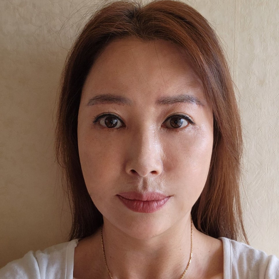 미니하안검잘하는곳에서 받아야 하는 이유 관련 이미지 1