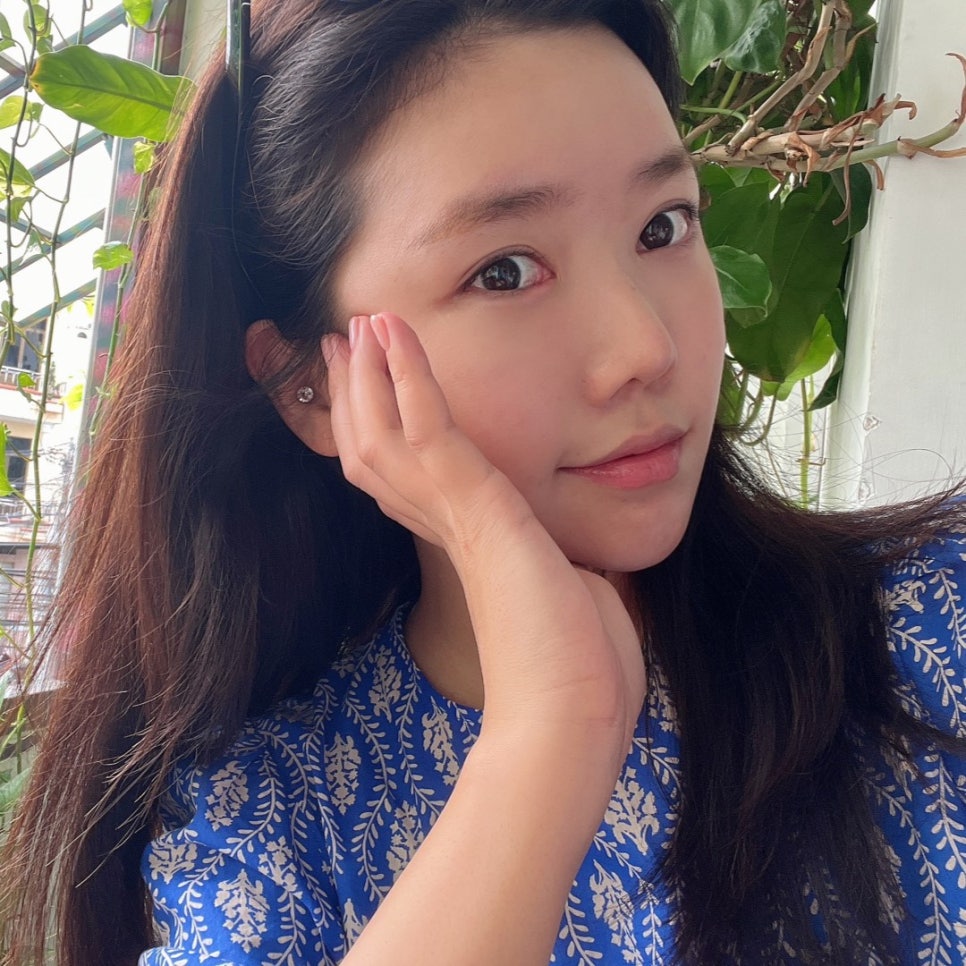 눈밑지로 다크서클과 피곤한 인상 개선했어요 관련 이미지 2