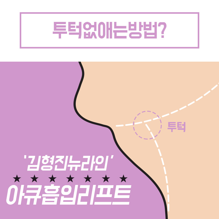 턱살지방흡입후기 확실한 곳 찾아요? 관련 이미지 4