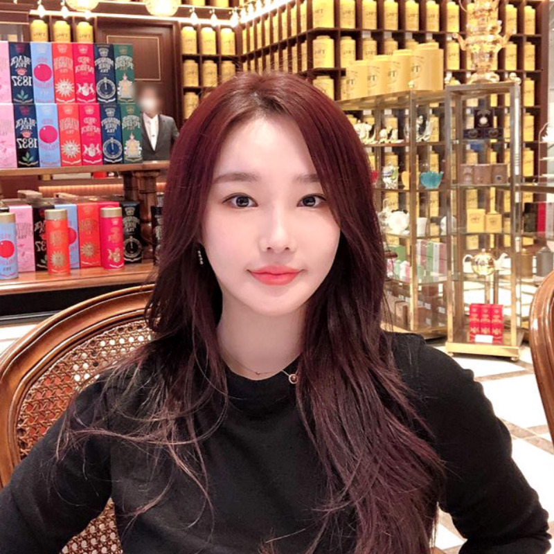 눈밑지방없애는방법 제대로 알고 해야죠! 관련 이미지 6