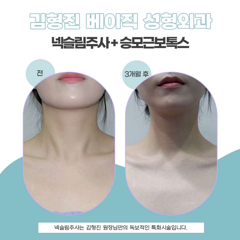 넥슬림주사후기 어떤 사람이 맞으면 좋을까? 관련 이미지 5