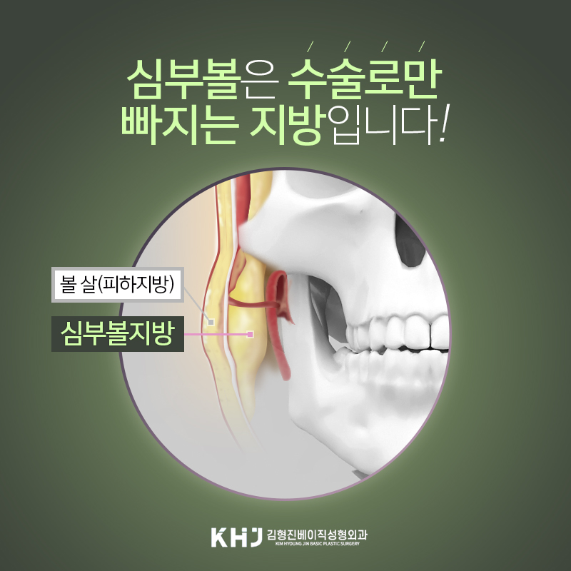 당신만 모르는 심부볼없애는법, 이 방법이 가장 빠릅니다! 관련 이미지 4