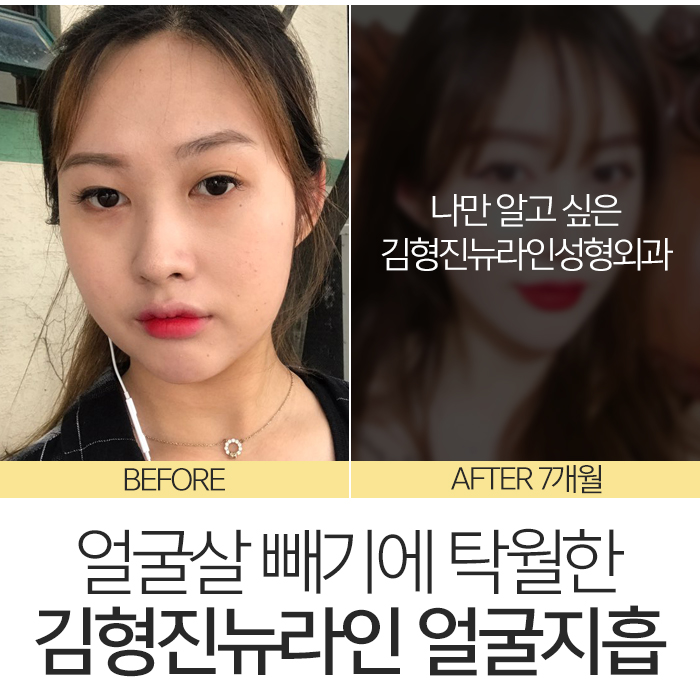얼굴살빼는법 이렇게나 쉽다니 관련 이미지 8