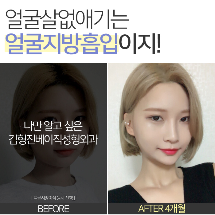 얼굴살없애기 이걸 몰랐단 말이야? 관련 이미지 7