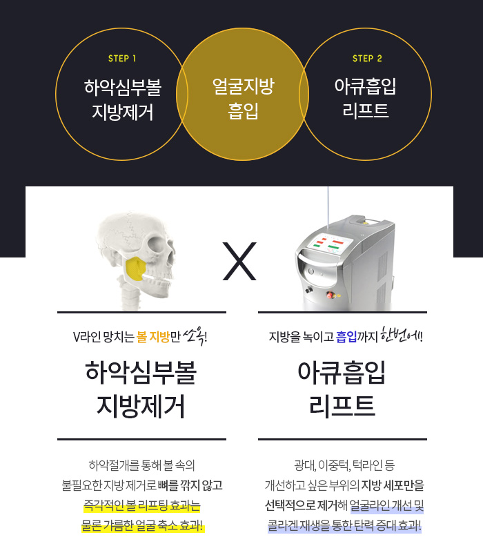 김형진베이직얼굴지흡 얼마나 잘하냐면요 관련 이미지 5