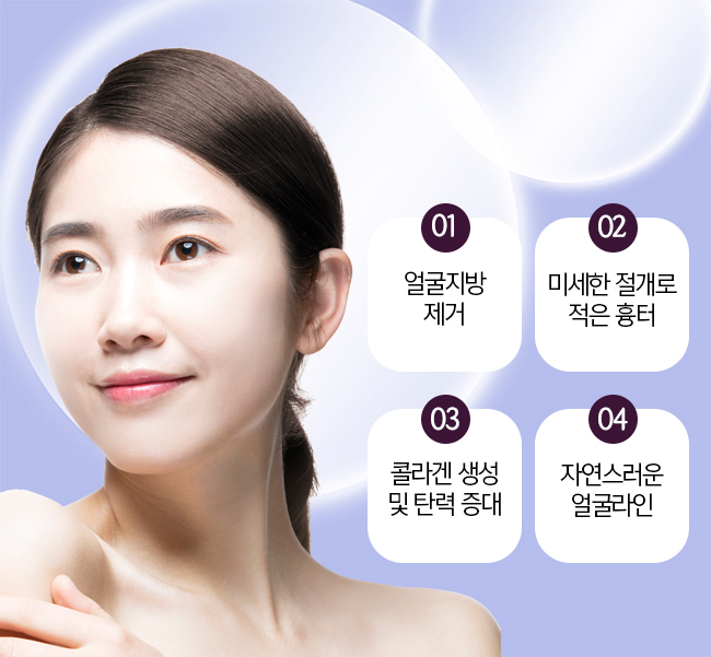 볼살 아큐스컬프 효과로 볼살을 벗자 ! 관련 이미지 3