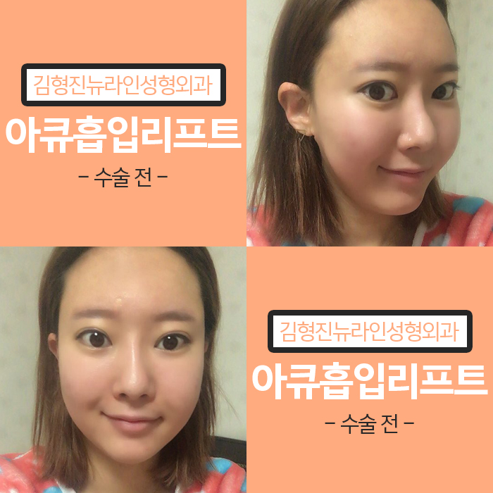 광대살빼기 어려운 게 아니네 관련 이미지 2