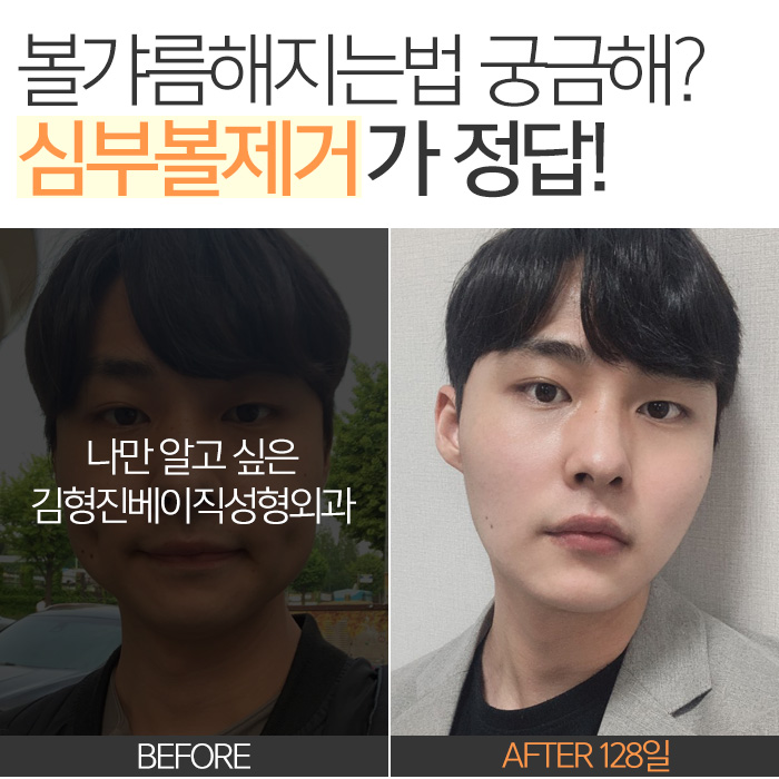 볼갸름해지는법 다 알고 있는데 관련 이미지 9