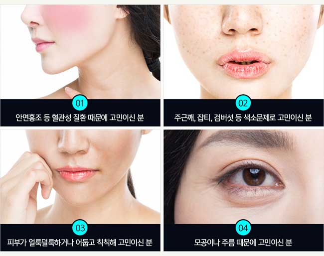 IPL 효과 제대로 보고 뽀~얀 아기피부! 관련 이미지 3