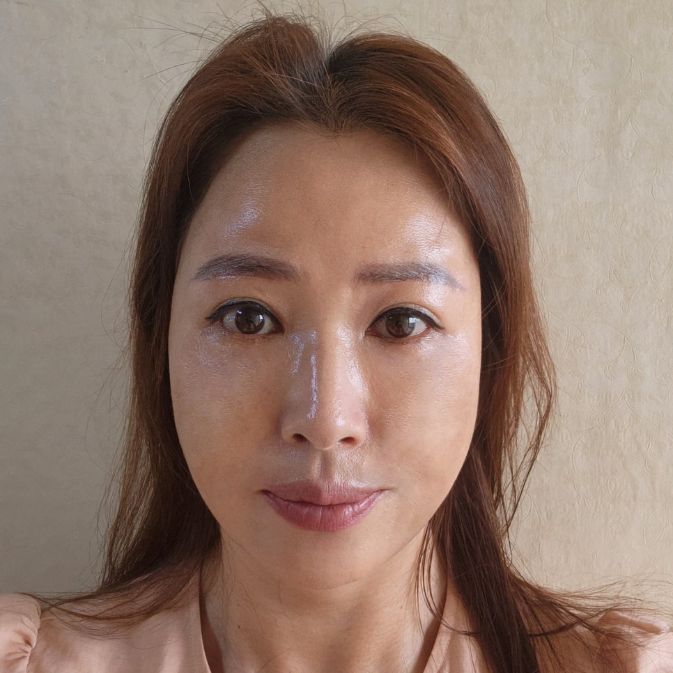 미니하안검전후 변화과정 확인하세요! 관련 이미지 1