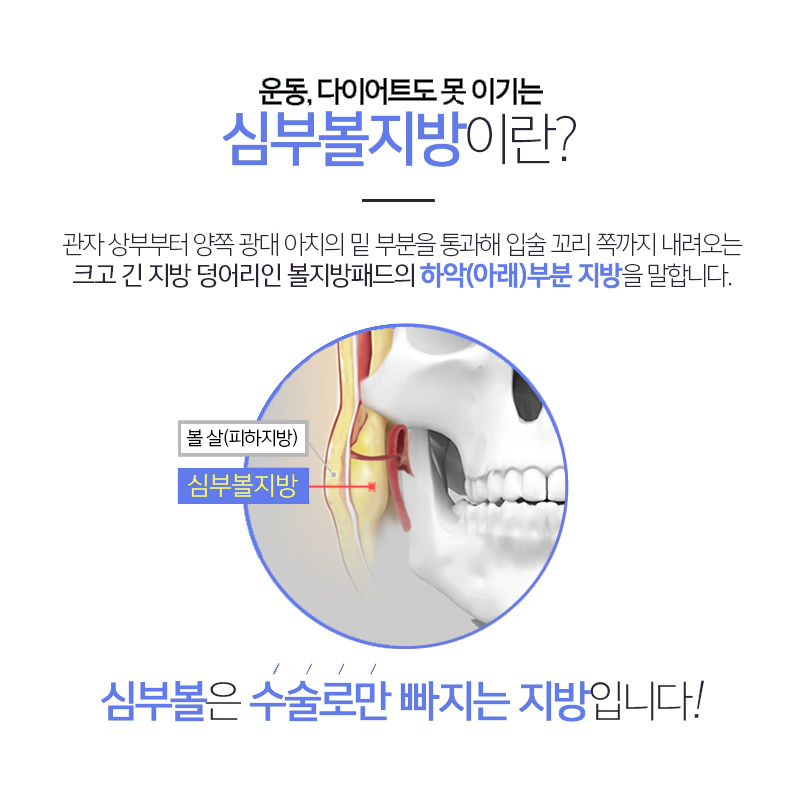 How to Reduce Facial Fat, If You Want a Clear V-Line? image 5