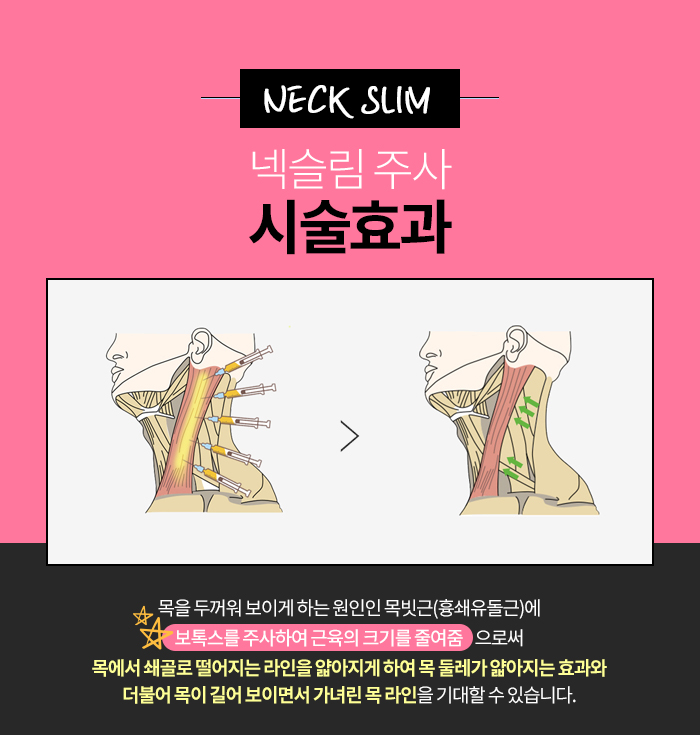 신부관리 이건 절대 빠질 수 없죠 관련 이미지 3