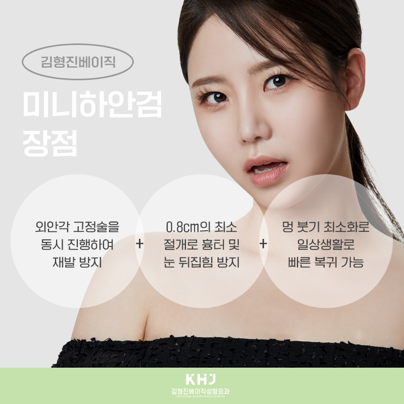 미니하안검붓기 적을 수밖에 없는 이유! 관련 이미지 5