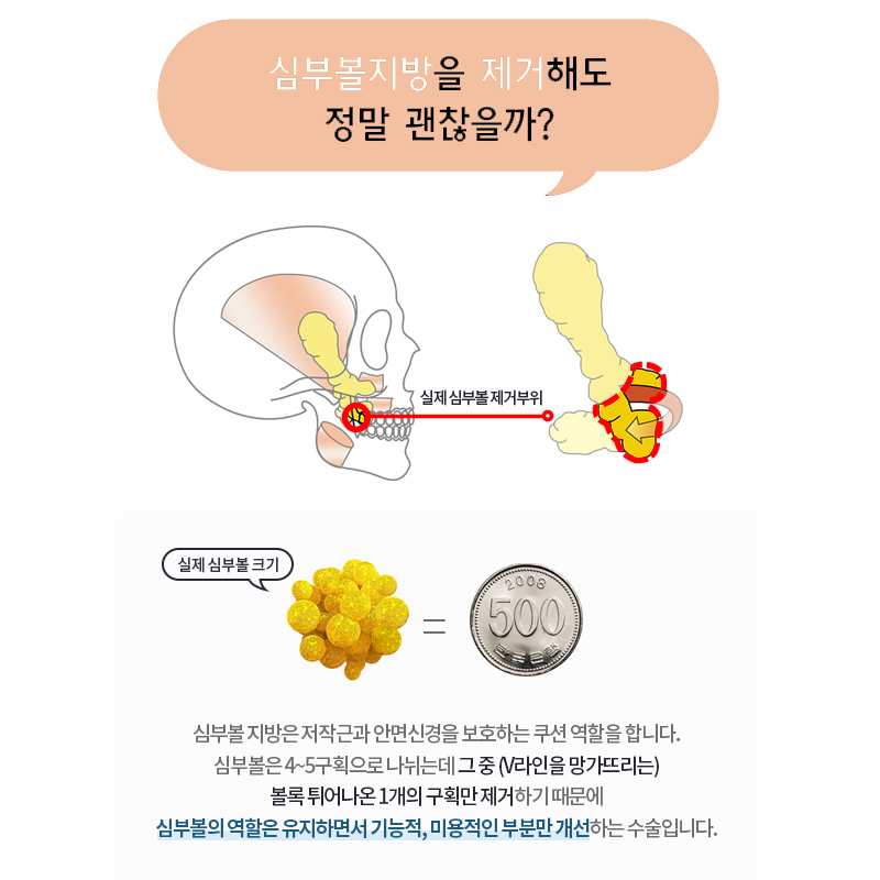 얼굴지흡효과 한 번 빼더라도 깨끗하고 말끔하게 관련 이미지 5