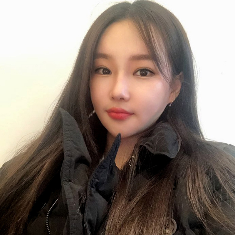 눈밑지방재배치전후 보러오실분 관련 이미지 1