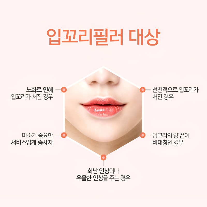 입꼬리필러시술 잘하는 곳 아직도 모르시나요? 관련 이미지 5