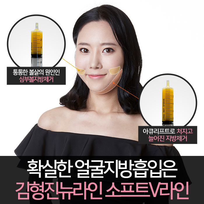 얼굴지방흡입후기 완벽 변신! 관련 이미지 4